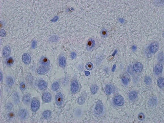 molecular processes