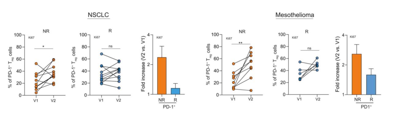 FIGURE 1 | Increased proliferation of PD-L+ regulatory T cells (Tregs) in peripheral blood after αPD-1/αPD-L1 treatment is associated with therapy resistance in non-small cell lung cancer (NSCLC) or mesothelioma 