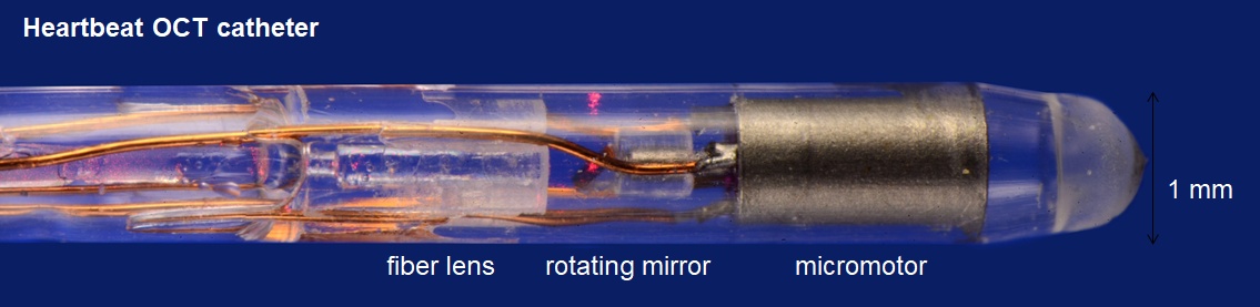 Heartbeat OCT catheter